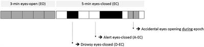 State Changes During Resting-State (Magneto)encephalographic Studies: The Effect of Drowsiness on Spectral, Connectivity, and Network Analyses